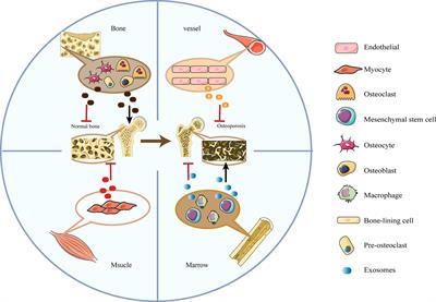 Exosomes: A Friend or Foe for Osteoporotic Fracture?